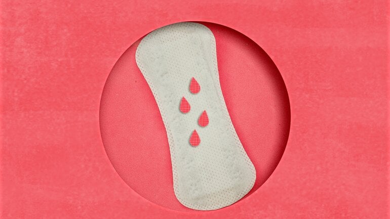 Unregelmäßige Blutungen sind Symptome bei Zyste in der Gebärmutter