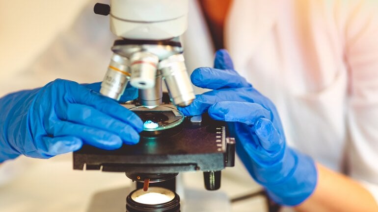 Wächterlymphknotenbiopsie bei schwarzem Hautkrebs