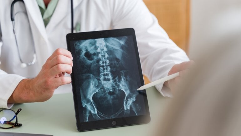 Symptome bei Metastasen in der Wirbelsäule