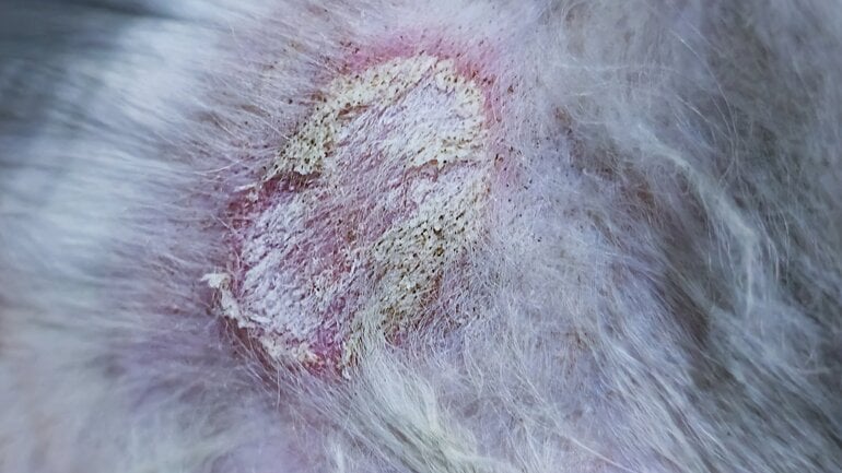 Katzenpilz kann auch Menschen befallen