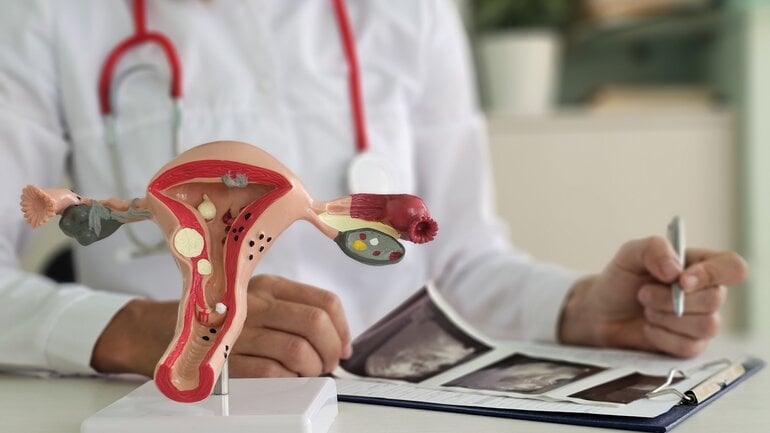 Gebärmutterhalskrebs: Fast immer HPV-bedingt