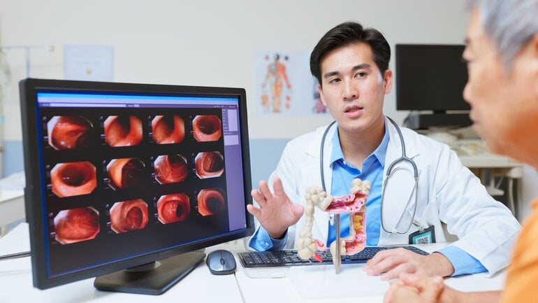 Die häufigsten Krebsarten: Darmkrebs