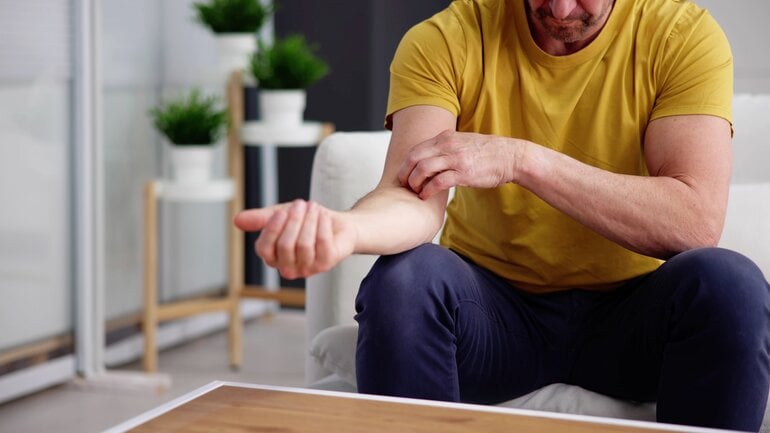 Leberfibrose kann zu Juckreiz am ganzen Körper führen