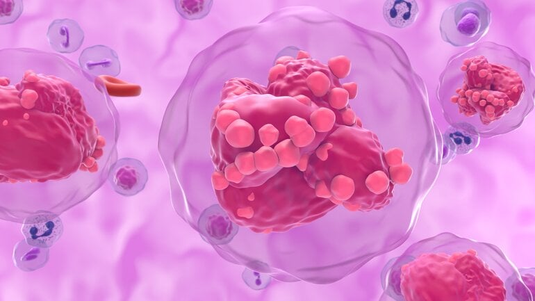 Leukämie verbreitet sich über das Blut