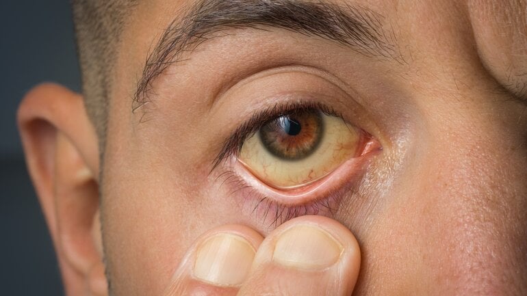 Leber kann bei Leukämie betroffen sein