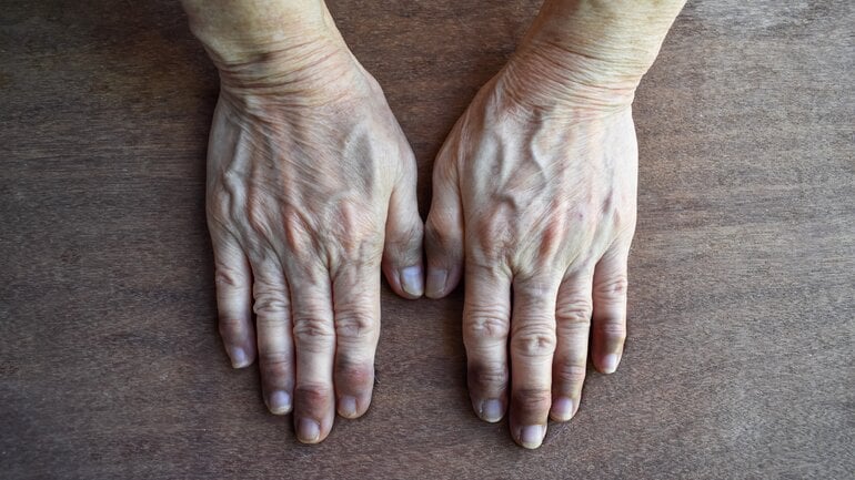 Wasser in der Lunge führt zu Sauerstoffmangel