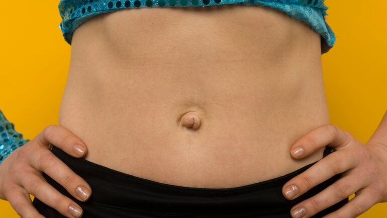 Foto: Wie sieht ein Nabelbruch bei Erwachsenen aus?
