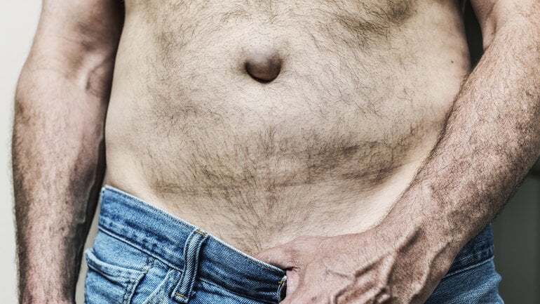 Nabelbruch beim Mann: Beschwerden bei körperlicher Belastung