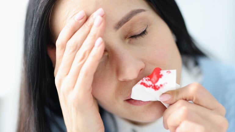 Nasenbluten ohne Grund? Stress als Auslöser