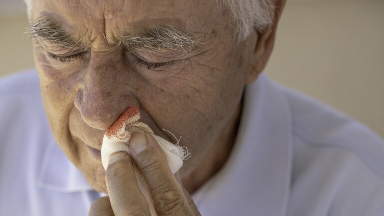 Nasenbluten bei älteren Personen: Mögliche Ursachen