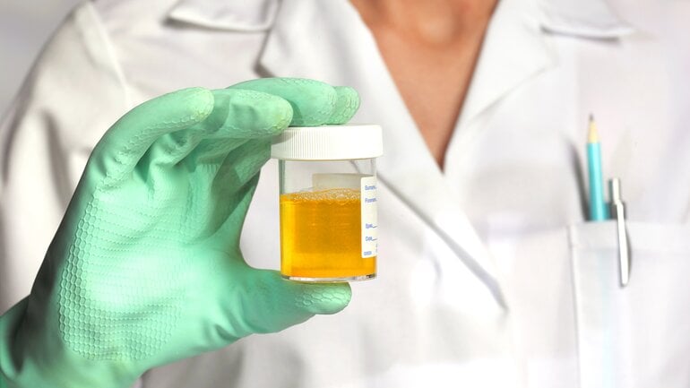 Nierenbeckenkrebs: Blut im Urin ist typisches Symptom