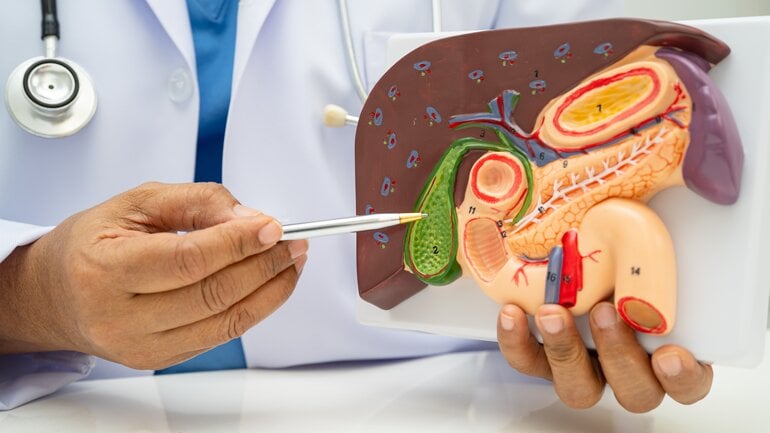 Akute Pankreatitis: Häufige Ursache sind Gallensteine