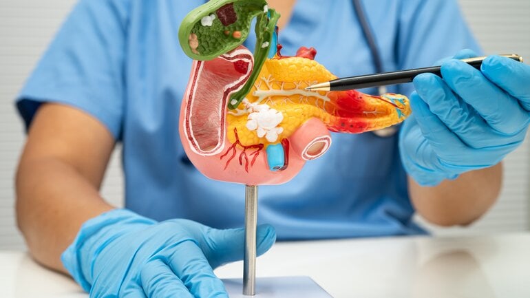 Seltene Ursachen einer Pankreatitis