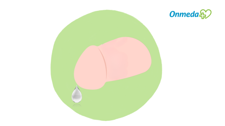 Klarer, glasiger Ausfluss aus dem Penis?