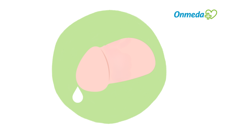 Weißer Ausfluss beim Mann ohne Schmerzen?