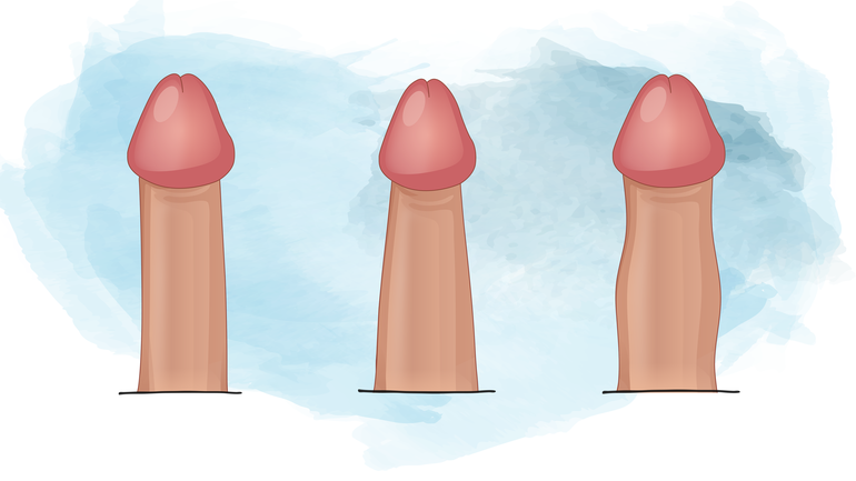 Penisschaft: Jeder Penis sieht anders aus