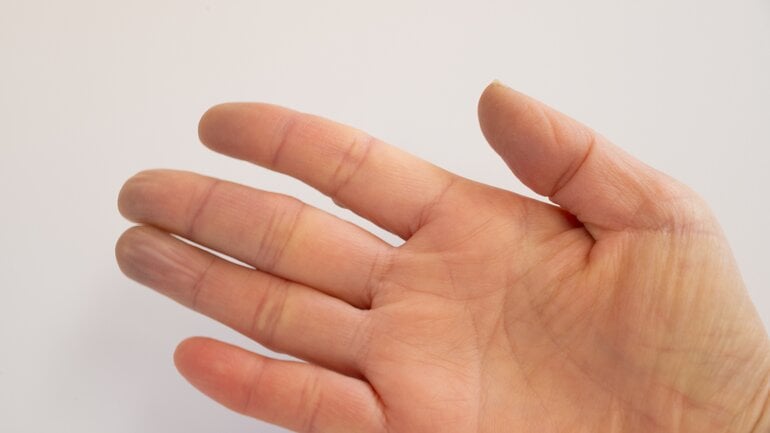 Pleuraerguss: Symptome bei Sauerstoffmangel