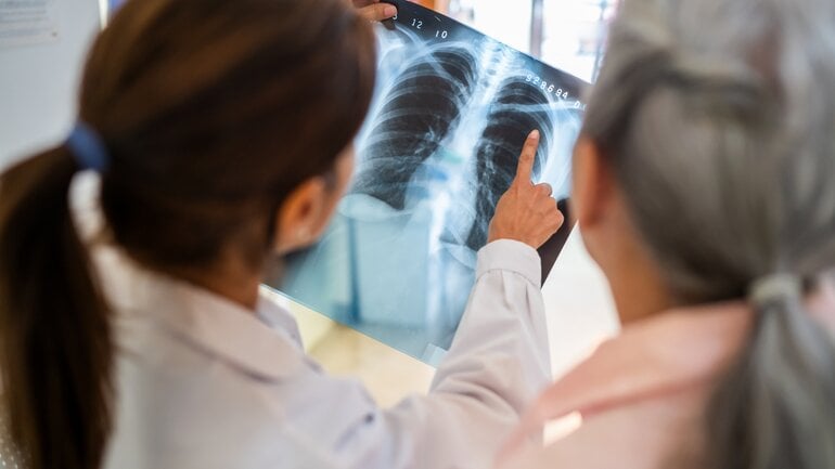 Behandlung bei feuchter Rippenfellentzündung