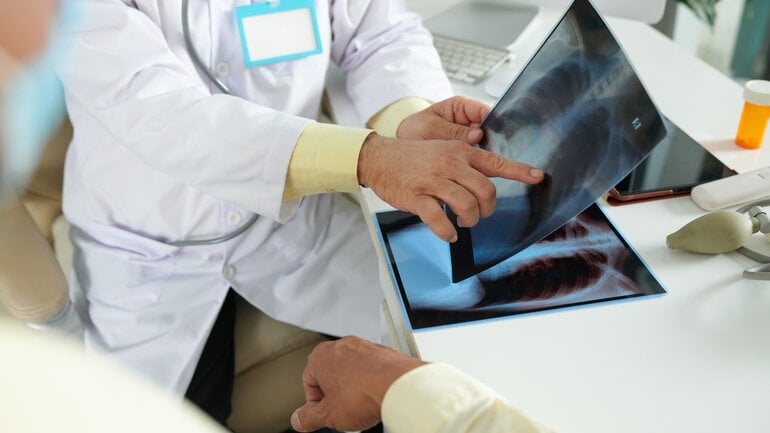 Symptome bei feuchter Rippenfellentzündung