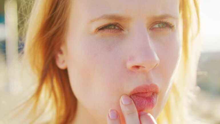 Lippen zu trocken: Sonnenstrahlung als Ursache