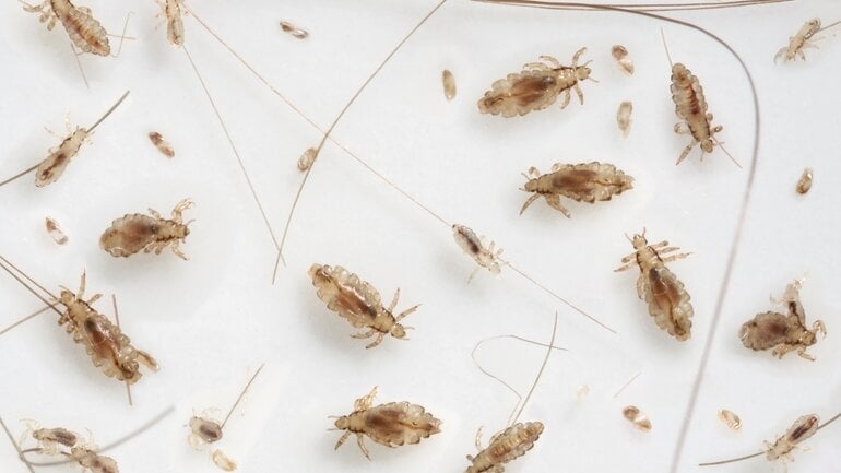 Läuse: Ungeziefer befallen meist Kopfhaar