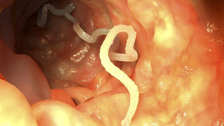 Unverdaute Nahrung im Stuhl durch Parasiten