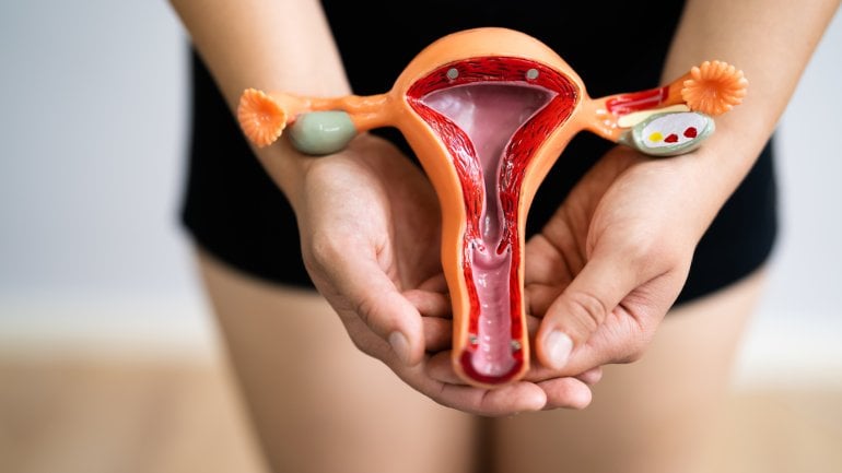 Sinnbild einer Hysterektomie: Frau hält Model einer Gebärmutter in den Händen.