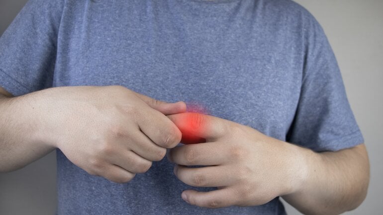 Schwellung, Rötung &amp; Schmerz: Entzündung oder Arthrose?