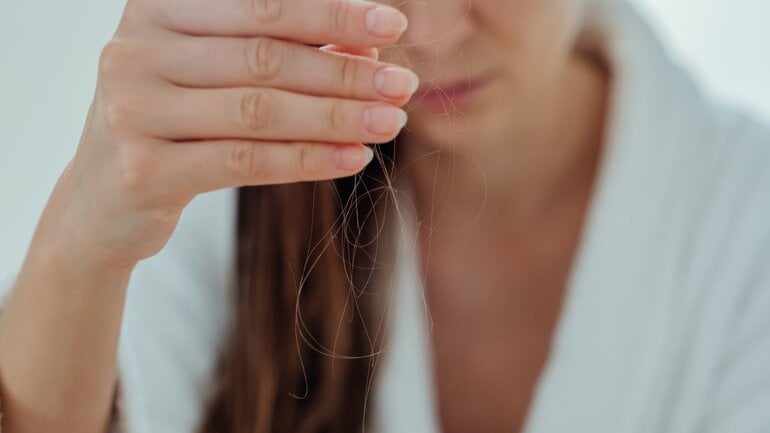 Biotin: Fehlt der Nährstoff, kann Haarausfall Folge sein