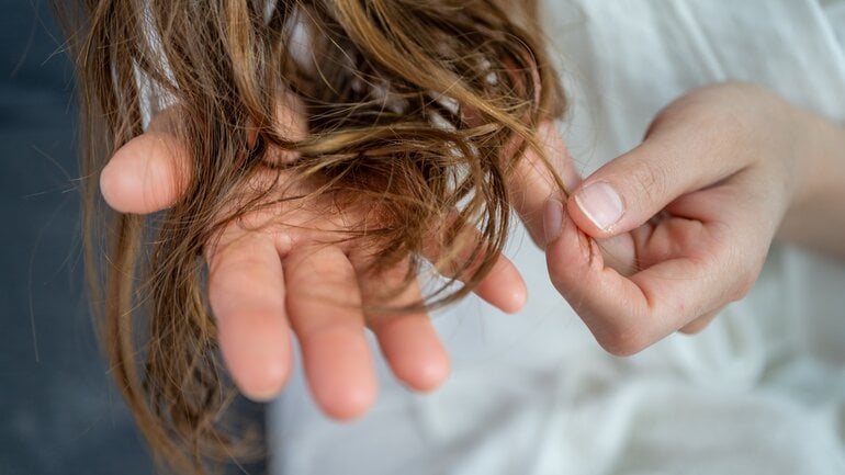 Kupfer: Nährstoff fehlt womöglich bei Haarausfall