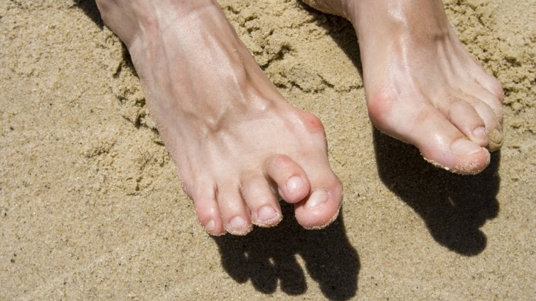 Das Bild zeigt Füße im Sand.