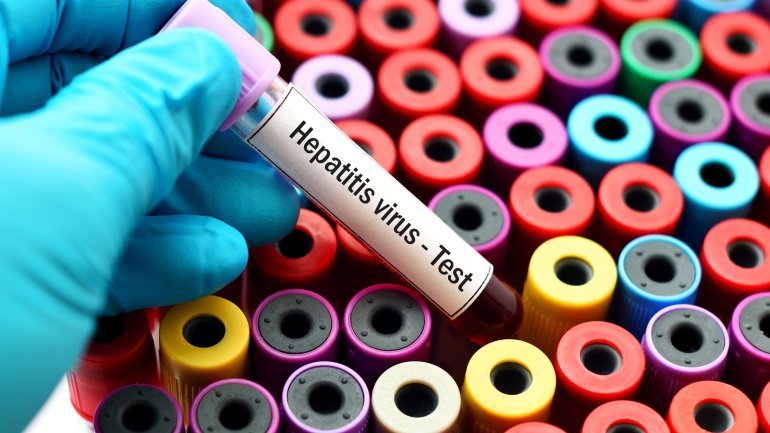 Jemand hält ein Teströhrchen mit roter Flüssigkeit und der Aufschrift Hepatitis Virus Test in dern Hand..