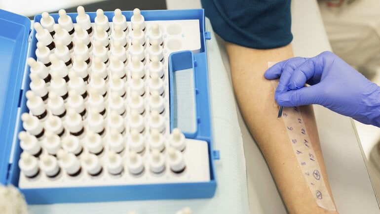 Heuschnupfen: Wann ärztlichen Rat aufsuchen?