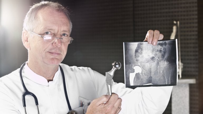 Ein Arzt hält ein Röntgenbild in die Höhe, auf dem ein eingepflanztes künstliches Hüftgelenk zu sehen ist, und hält zum Vergleich eine Hüftprothese daneben.