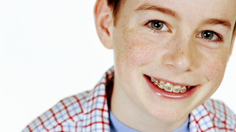 Das Bild zeigt einen Jungen mit Zahnspange.