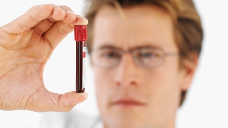 Ein Arzt betrachtet ein Röhrchen mit einer Blutprobe.