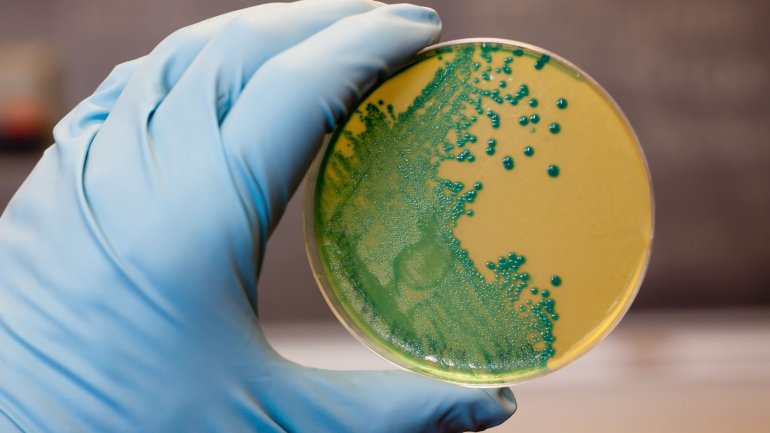 Listeriose: Medizinisches Personal hält Bakterienkultur mit Listerien in der Hand.