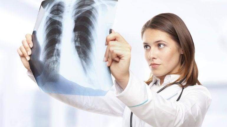 Das Bild zeigt eine Ärztin, die ein Röntgenbild betrachtet.