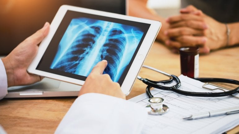 Lungenkrebs: Ärztliches Gespräch mit Röntgenbild der Lunge.