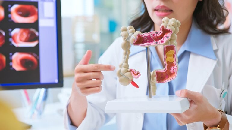 Erhöhtes Risiko für Darmkrebs und Gebärmutterkrebs