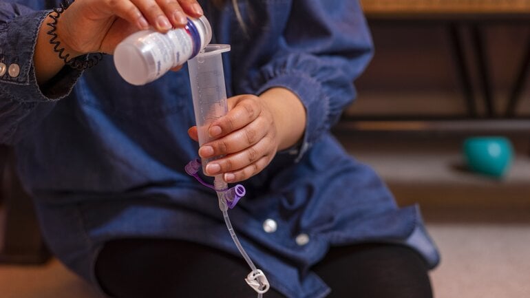 Magensonde: Frau füllt Behältnis mit Flüssignahrung