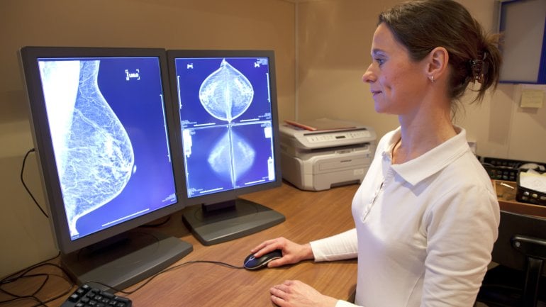 Das Bild zeigt Ultraschallaufnahmen einer weiblichen Brust.