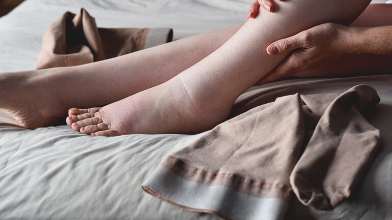 Morbus Crohn: Eiweißmangel bei schwerem Krankheitsverlauf