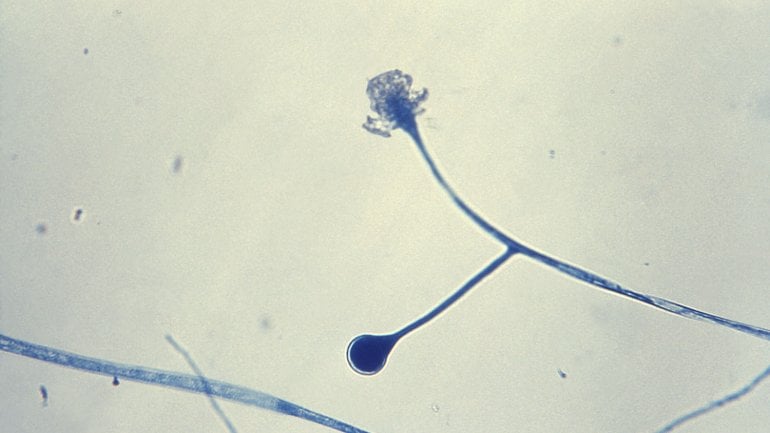 Man sieht eine mikroskopische Aufnahme von Sporangien der Schimmelpilz-Gattung Mucor.