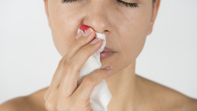 Das Bild zeigt eine Frau mit Nasenbluten