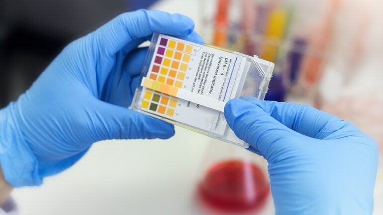 Blut im Urin kann Symptom für Nierenzyste sein