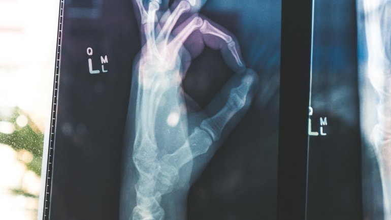 Zu sehen ist das Röntgenbild einer Hand, die das Okay-Zeichen formt.