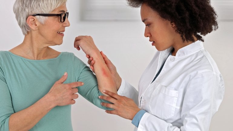 Eine Frau zeigt einer Hautärztin eine Hautveränderung am Arm.