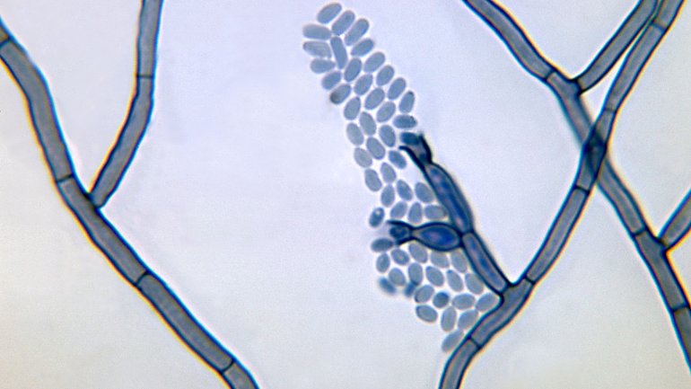 Mikroskopische Aufnahme von Phialophora verrucosa.