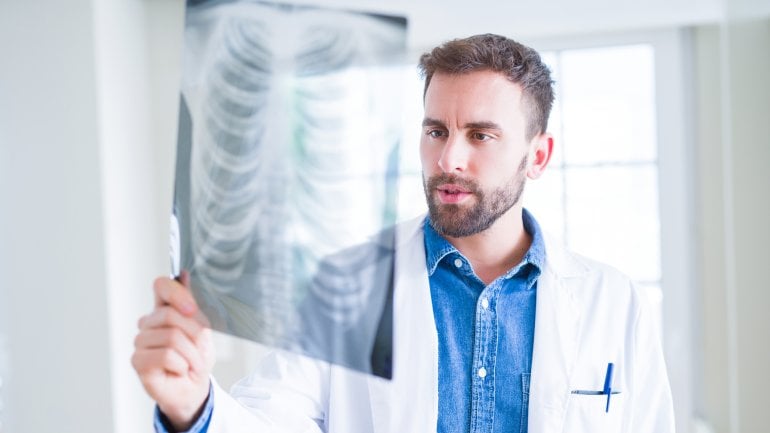 Das Bild zeigt einen jungen Arzt, der auf eine Röntgenaufnahme des Brustkorbs schaut.